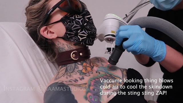 First Laser Tattoo Removal session - removing my whole chest tattoo! смотреть онлайн