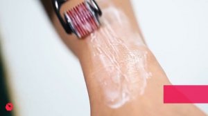 Derma Roller System 540