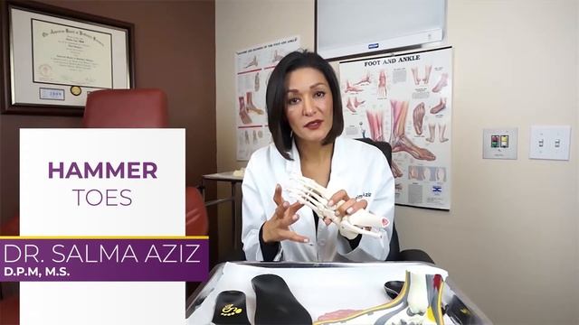 Hammer Toes by Dr. Salma Aziz at Foot and Ankle Specialty Group in Orange County смотреть онлайн