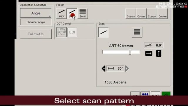 HOW TO: SPECTRALIS Anterior Segment OCT Module The perfect Acquisition смотреть онлайн