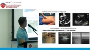 Неотложный ультразвуковой протокол eFAST − первичная сортировка Филявин Р.Э 2018