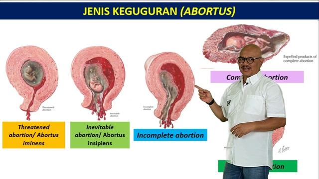 Kupas Tuntas ABORTUS #1 | SERI ABORTUS смотреть онлайн
