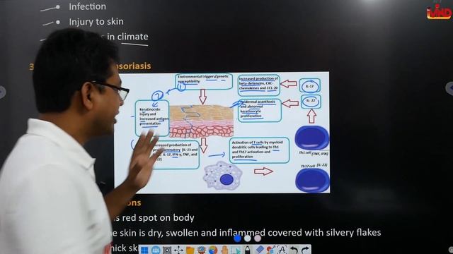 Psoriasis | CH-2(i) | L-1 | Dermatalogy | Pharmacotherapeutics | D.Pharm second year смотреть онлайн