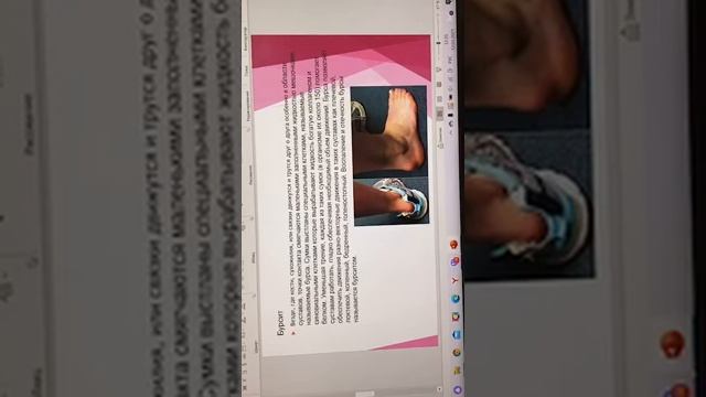 dostup podo Деформация стоп, правило подбора обуви для клиента proekt nails смотреть онлайн