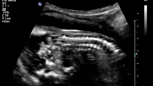 Baby Chester 19 weeks Girl смотреть онлайн