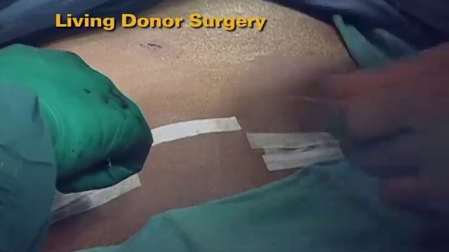 U-M Kidney Transplant Donor - Surgery (5 of 7) смотреть онлайн