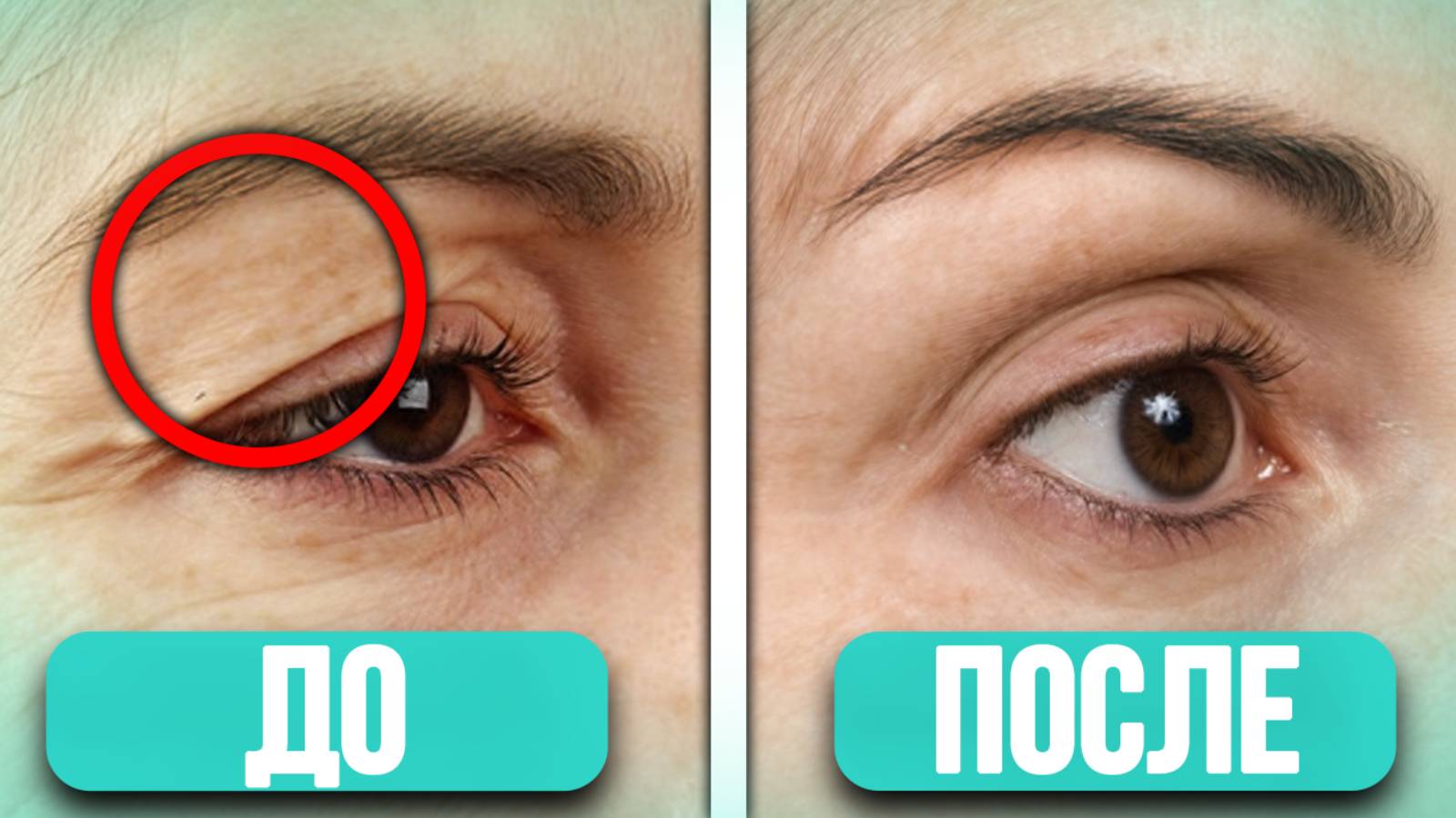 Убираем нависшее веко БЕЗ КОСМЕТИКИ! / Как сохранить МОЛОДОСТЬ кожи вокруг глаз? смотреть онлайн