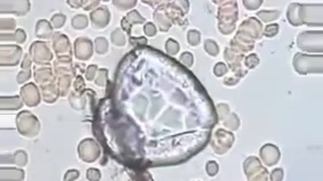Так действует на кровь живая вода смотреть онлайн