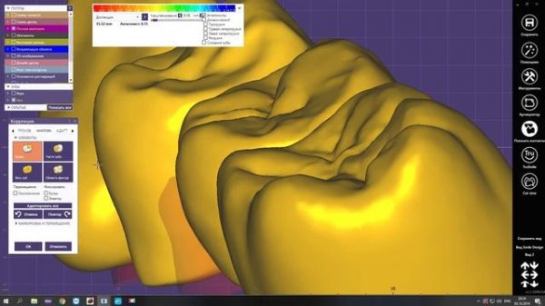 EXOCAD. Зеркальное копирование зубного ряда. Mirroring set of teeth