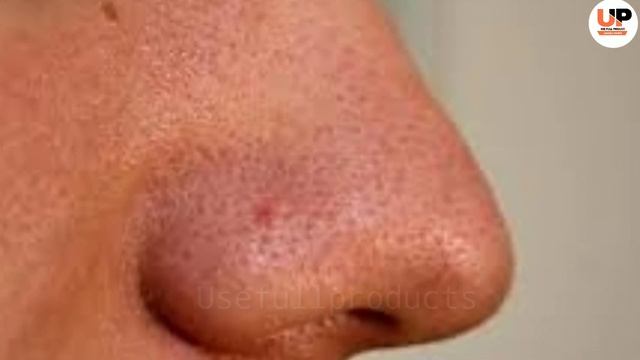 glayco - 6 Cream Review | Pigmentation | Melasma | Acne | Glycolic Acid | Usefullproducts смотреть онлайн