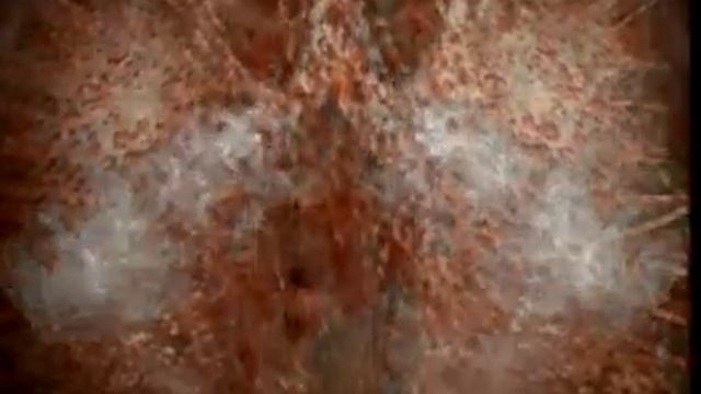 Жесть ....и после этого вы еще хотите курить? смотреть онлайн
