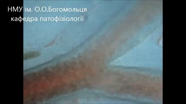 Реверс крови