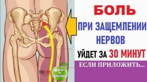 Чем снять Боль при защемлении нервов