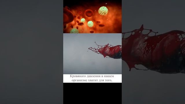 😫😫😫 Фонтан крови в 10 метров смотреть онлайн