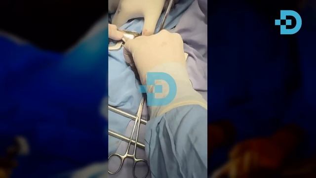 ДАҲШАТ! 15 ЁШЛИ ҚИЗНИНГ ОШҚОЗОНИДАН КАТТА ТОШ ЧИҚДИ смотреть онлайн