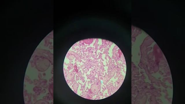 Placenta and Blastula (3/5) смотреть онлайн