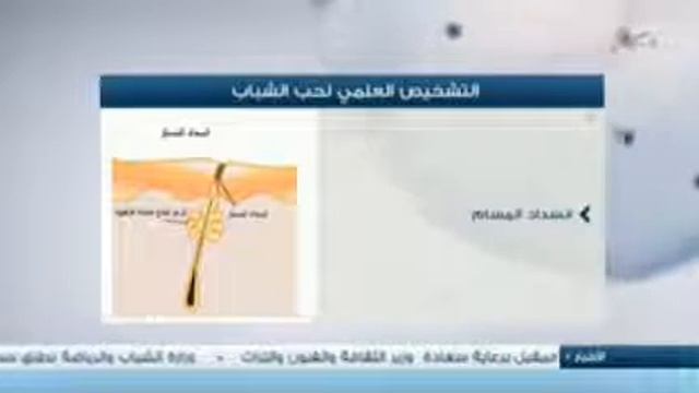 Pharmaceris Derma Club of Qatar (PDCQ) first meeting @ Qatar TV смотреть онлайн