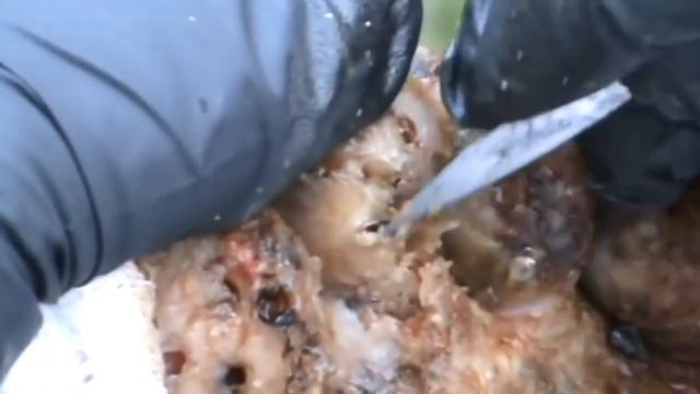 Jiggers Torn Off l One Of The Scariest Feet In Africa v4 смотреть онлайн