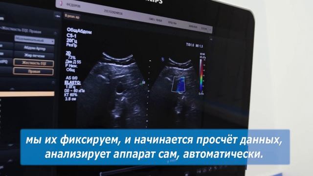 Клиника CMD: терапевт, врач УЗД Виктория Иневатова смотреть онлайн