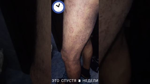 Отзыв хх 1мес хемохим смотреть онлайн