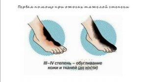 9. Первая помощь при ожогах