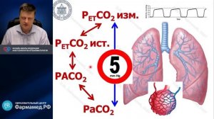 Капнография Лебединский К.М