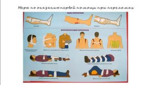 11. Первая помощь при переломах