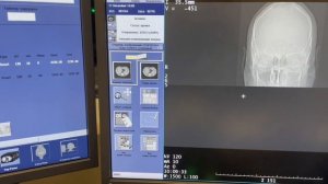 КТ височных костей
Обучение 
Кт оборудования GE OPTIMA