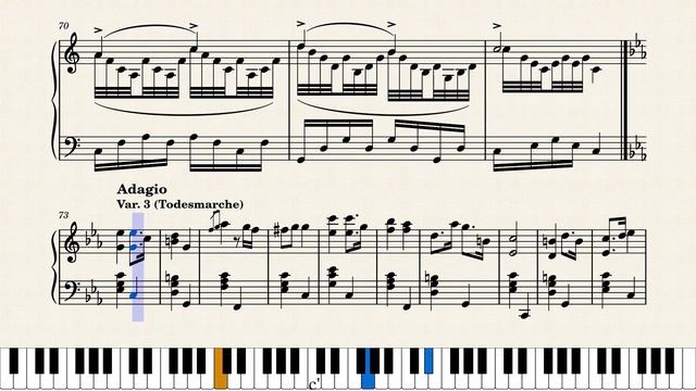 5 Variations on a Theme by Amane Kanata, KV.003 смотреть онлайн