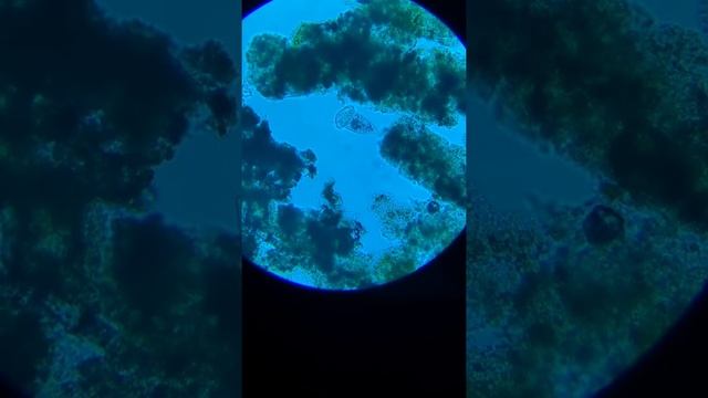 Vorticella blue filter under a microscope смотреть онлайн