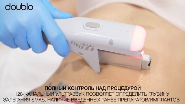 Ультразвуковой SMAS-лифтинг Doublo по телу смотреть онлайн