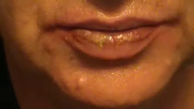 WEEK-3- Cancer Series- Top Lip All Well смотреть онлайн