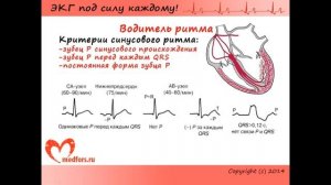 Урок 3  Видеокурс ЭКГ под силу каждому