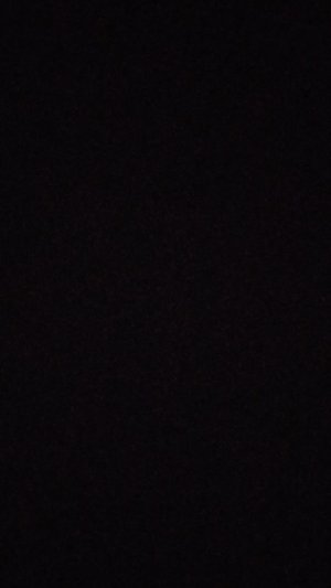 взорвалась в руках китайская петарда (рофл)просто песня