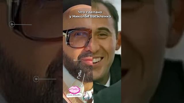 Николай Василенко , какие процедуры чаще делают мужчина #обучениекосметологов #красота #губымосква