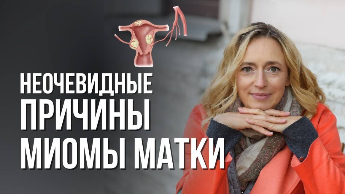 Миома матки. Как себе помочь? смотреть онлайн