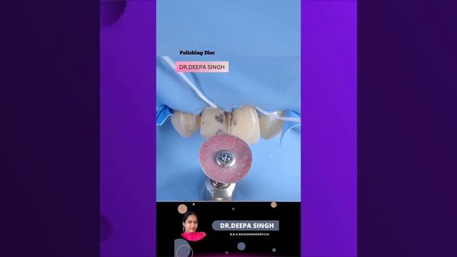 DENTAL CARIES-CLEANING & FILLING смотреть онлайн