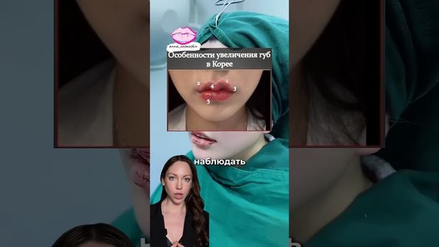 Какие губы считаются красивыми #обучениекосметологов #красота #губымосква