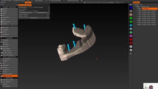 Ez3D-i byzzCad Surgical Guide Tutorial 092021 смотреть онлайн