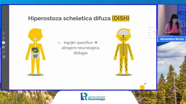 Școala de vară a tinerilor reumatologi 13 Iulie 2023 - Alexandra Burlui смотреть онлайн