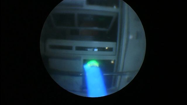 Thulium Laser En Bloc Resection Of Bladder Tumour. Case #36