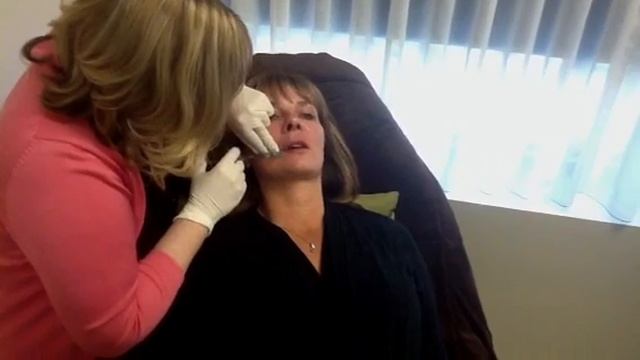 Juvederm Spa35 смотреть онлайн