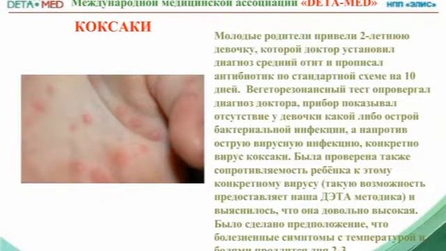 ЕМ Амшей Личный опыт врача смотреть онлайн