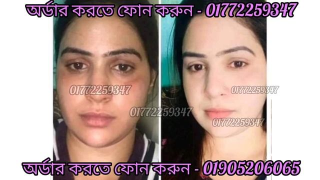 (ALIKE BOOST LUSTER Retinoid Lifting Whitening Cream/how to use)ত্বক ধবধবে ফর্সা করার ক্রিম смотреть онлайн
