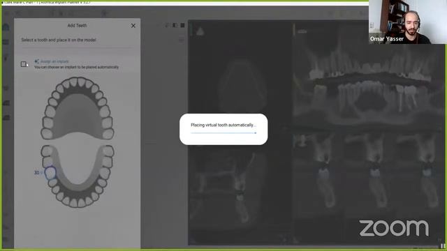 NDPO Friday and Sunday Webinars смотреть онлайн