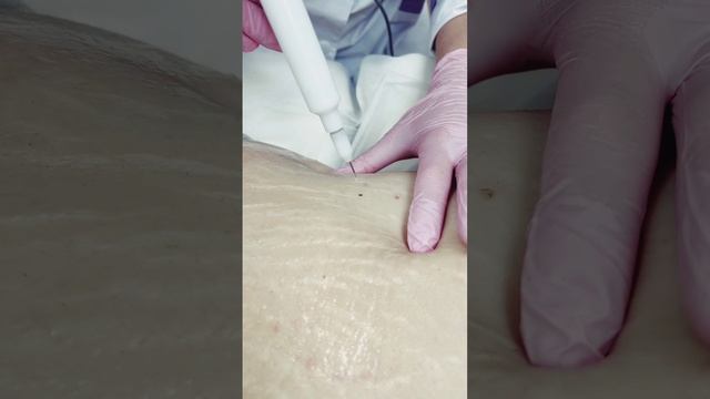 Работа с растяжками