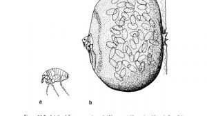 Jigger’s disease