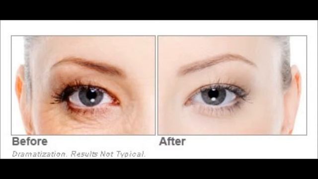 Eye Cream by Revitol смотреть онлайн