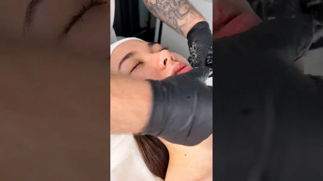 Профессиональный пилинг KLAPP Hyaluronic MLP #klapp #косметология смотреть онлайн