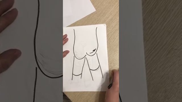 Дисплазия ТБС смотреть онлайн